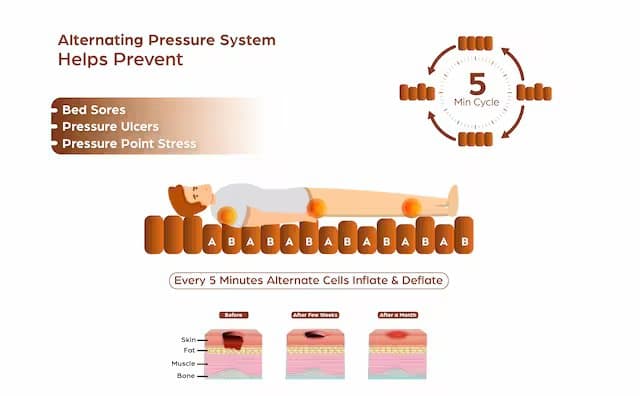 Anti Decubitus Air Bubble Mattress with Pump for Bedridden Patients Medical Grade EZ AIR 115C 7